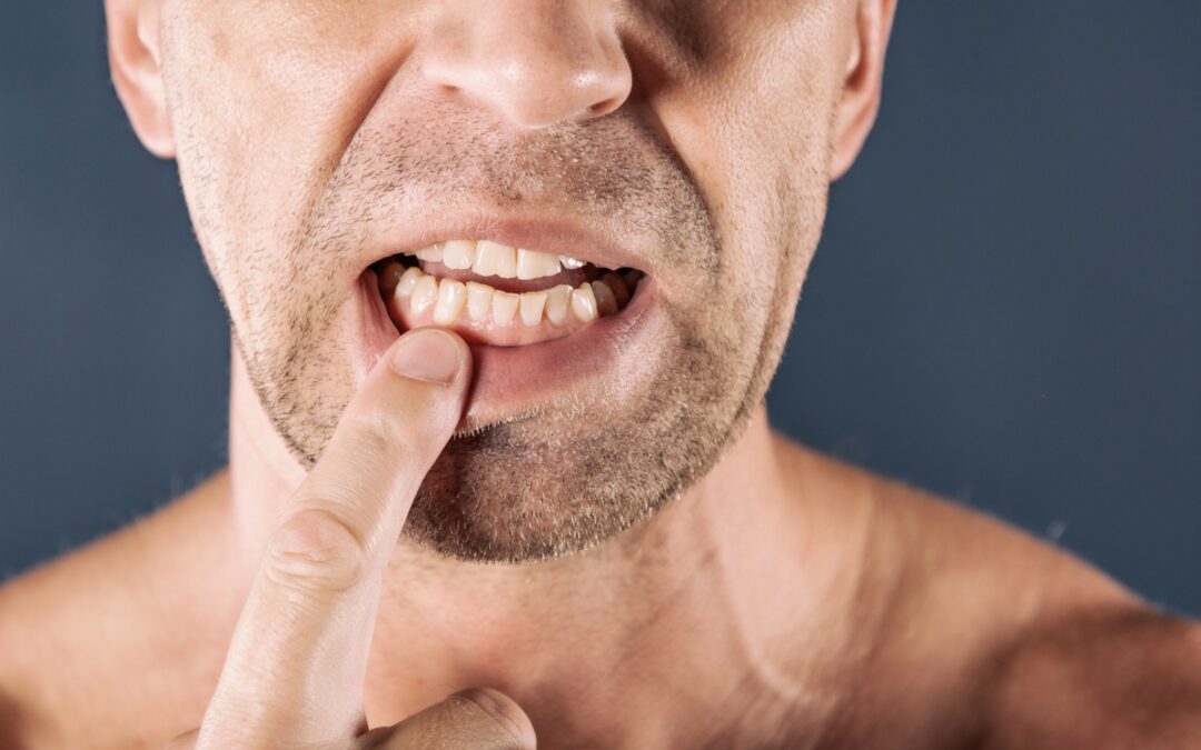 4 Signs You Have Periodontal (Gum) Disease