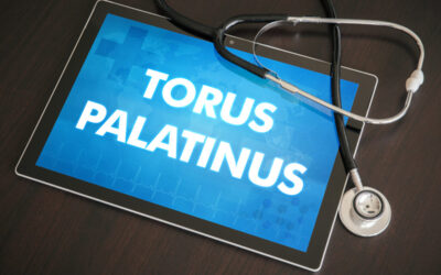 Do You Need Tori Removal? Understanding When It’s Time to Consider Surgery