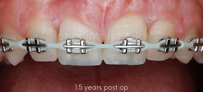 What Life Looks Like After