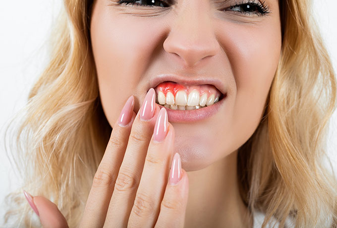 Why Treating Gum Disease Matters