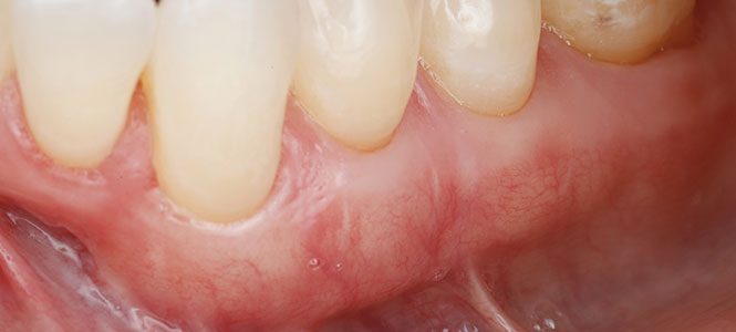 What You Can Expect from Treatment