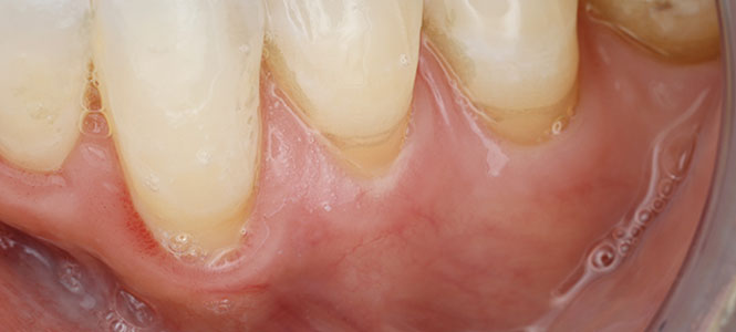 What You Can Expect from Treatment