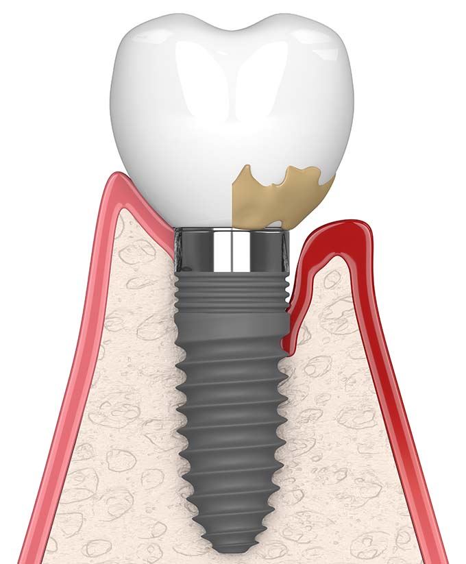 Recognizing the Signs