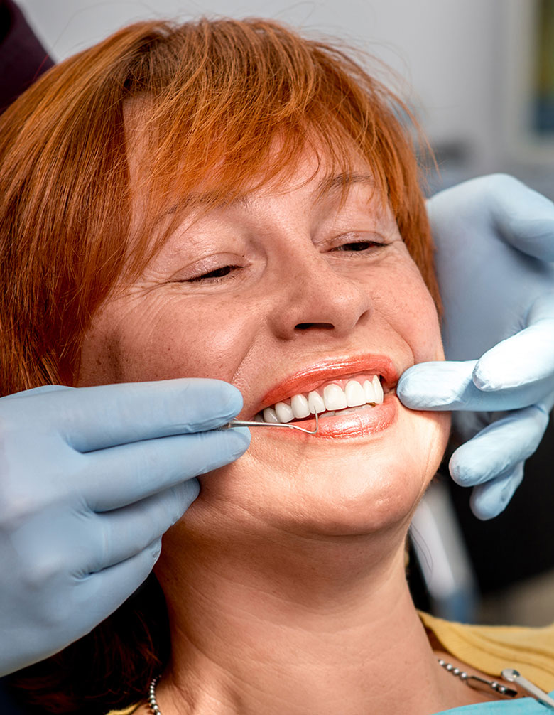 All on X / All On 4 Full Arch Implants