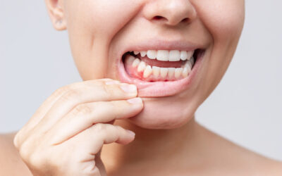 What Happens If Gum Disease Goes Untreated for Years?