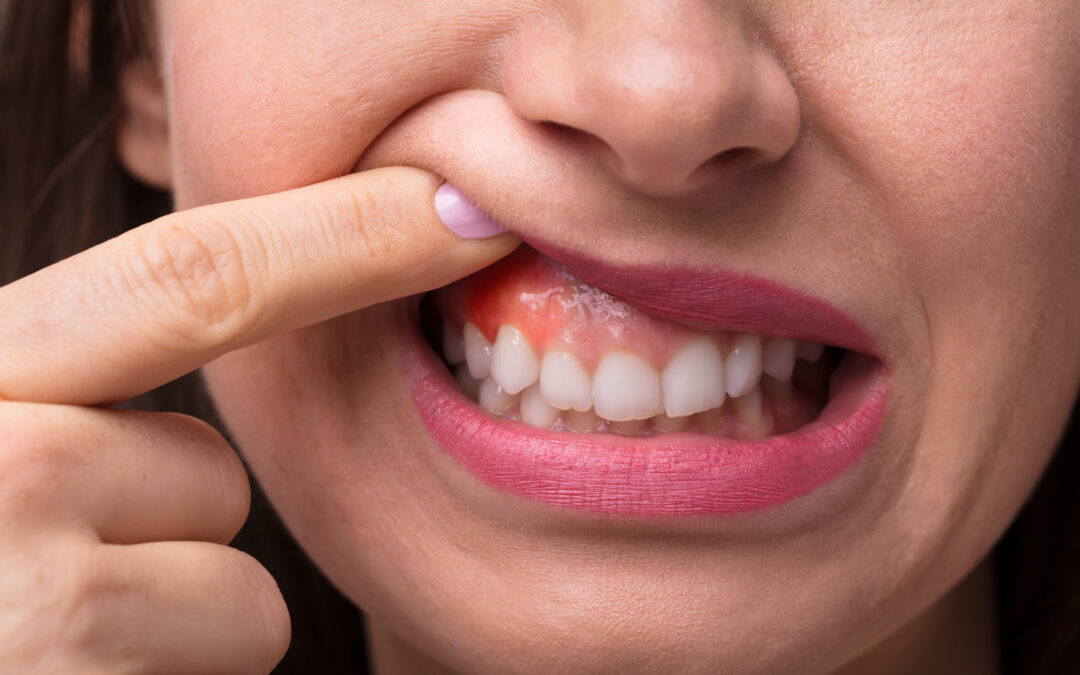 Why Gum Recession Gets Worse Over Time — And How Modern Treatment Can Restore Protection