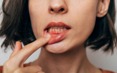 What Is LANAP and How Is It Different from Traditional Gum Surgery?